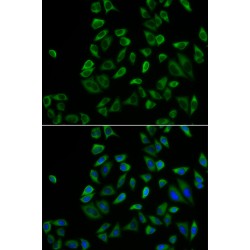 Peroxisomal Biogenesis Factor 5 (PEX5) Antibody