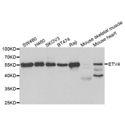 Western blot analysis of extracts of various cell lines, using ETV4 antibody (abx004440) at 1/1000 dilution.