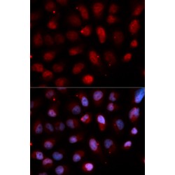 ETS Translocation Variant 4 (ETV4) Antibody