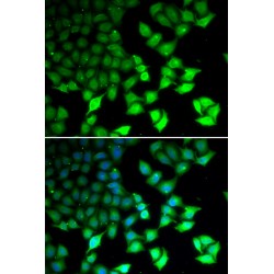 Lysine Demethylase 4B (KDM4B) Antibody