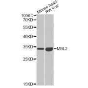 Western blot analysis of extracts of various cell lines, using MBL2 antibody (abx004465) at 1/1000 dilution.