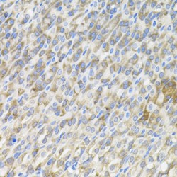 Mannose-Binding Protein C (MBL2) Antibody