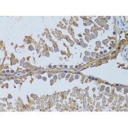 Histone Deacetylase 8 (HDAC8) Antibody