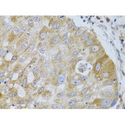 Histone Deacetylase 8 (HDAC8) Antibody