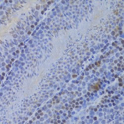 Lymphoid-Specific Helicase (HELLS) Antibody