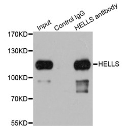 Lymphoid-Specific Helicase (HELLS) Antibody