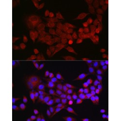 Inhibin Beta A (INHBA) Antibody