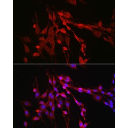 Inhibin Beta A (INHBA) Antibody