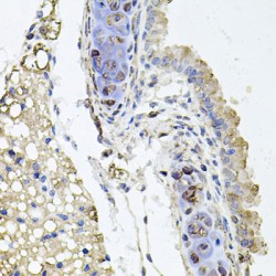 Mitochondrial Rho GTPase 1 (RHOT1) Antibody