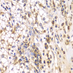 SRSF Protein Kinase 1 (SRPK1) Antibody