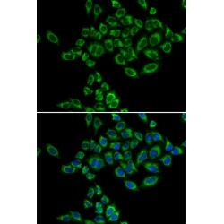 SRSF Protein Kinase 1 (SRPK1) Antibody