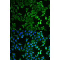 NPR2 Like, GATOR1 Complex Subunit (NPRL2) Antibody