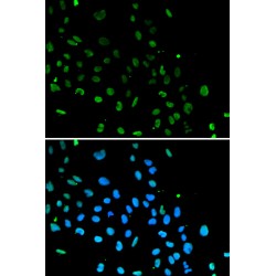 X-Ray Repair Cross Complementing 5 (XRCC5) Antibody