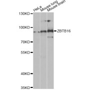 Western blot analysis of extracts of various cell lines, using ZBTB16 Antibody (abx004500) at 1/1000 dilution.