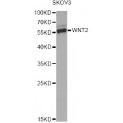 Western blot analysis of extracts of SKOV3 cells, using WNT2 Antibody (abx004501) at 1/1000 dilution.