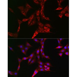 Transferrin Receptor Protein 1 / CD71 (TFRC) Antibody