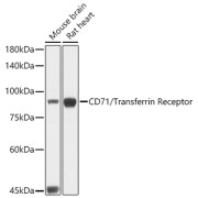 Western blot analysis of extracts of Mouse brain (Lane 1) and Rat heart (Lane 2) tissues (25 μg per lane), using Transferrin Receptor Protein 1 / CD71 Antibody (1/1000 dilution) followed by HRP-conjugated Goat Anti-Rabbit IgG H+L (<a href="https://www.abbexa.com/index.php?route=product/request&search=abx005548">abx005548</a>, 1/10000 dilution) and 3% non-fat dry milk in TBST for blocking.