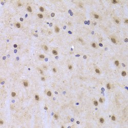 Interleukin Enhancer-Binding Factor 2 (ILF2) Antibody