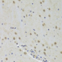 Interleukin Enhancer-Binding Factor 2 (ILF2) Antibody