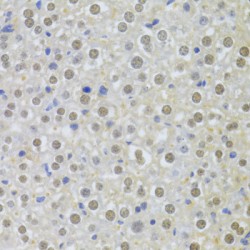 Interleukin Enhancer-Binding Factor 2 (ILF2) Antibody