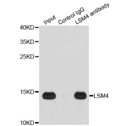 LSM4 Homolog, U6 Small Nuclear RNA And mRNA Degradation Associated (LSM4) Antibody