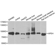 Western blot analysis of extracts of various cell lines, using APEH antibody (abx004520) at 1/1000 dilution.