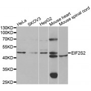 Western blot analysis of extracts of various cell lines, using EIF2S2 antibody (abx004521) at 1/1000 dilution.