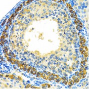 Immunohistochemistry of paraffin-embedded rat ovary using MRPL28 antibody (abx004523) at dilution of 1/100 (40x lens).