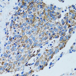 Mitochondrial Ribosomal Protein L28 (MRPL28) Antibody