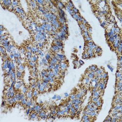 Mitochondrial Ribosomal Protein L28 (MRPL28) Antibody
