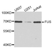 Western blot analysis of extracts of various cell lines, using FUS antibody (abx004538) at 1/1000 dilution.