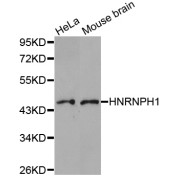 Western blot analysis of extracts of various cell lines, using HNRNPH1 antibody (abx004540).