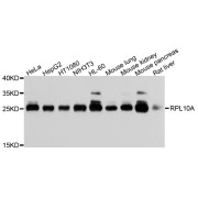 Western blot analysis of extracts of various cell lines, using RPL10A antibody (abx004541) at 1/1000 dilution.