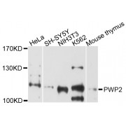 Western blot analysis of extracts of various cell lines, using PWP2 antibody (abx004545) at 1/1000 dilution.