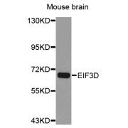 Western blot analysis of extracts of mouse brain, using EIF3D antibody (abx004562).