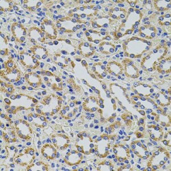 tRNA (uracil-5-)-Methyltransferase Homolog A (TRMT2A) Antibody