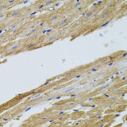 tRNA (uracil-5-)-Methyltransferase Homolog A (TRMT2A) Antibody