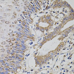 tRNA (uracil-5-)-Methyltransferase Homolog A (TRMT2A) Antibody