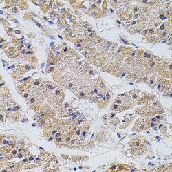 tRNA (uracil-5-)-Methyltransferase Homolog A (TRMT2A) Antibody