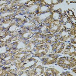 tRNA (uracil-5-)-Methyltransferase Homolog A (TRMT2A) Antibody