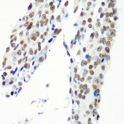 HIV TAT Specific Factor 1 (HTATSF1) Antibody