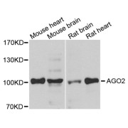 Western blot analysis of extracts of various cell lines, using AGO2 antibody (abx004631) at 1/1000 dilution.