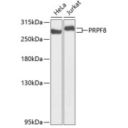 Western blot analysis of HeLa and Jurkat cells (25 μg per lane) using PRPF8 antibody (abx004657, 1/1000 dilution) followed by secondary antibody HRP-Conjugated Goat Anti-Rabbit IgG, H+L (<a href = "https://www.abbexa.com/goat-anti-rabbit-igg-hl-antibody-hrp-p-44932">abx005548</a>, 1/10000 dilution), and 3% non-fat dried milk in TBST for blocking.