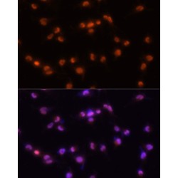 Pre-mRNA Processing Factor 8 (PRPF8) Antibody