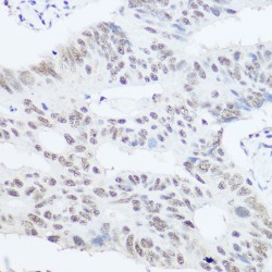 Pre-mRNA Processing Factor 8 (PRPF8) Antibody