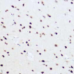 Pre-mRNA Processing Factor 8 (PRPF8) Antibody