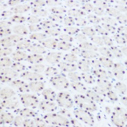 Pre-mRNA Processing Factor 8 (PRPF8) Antibody