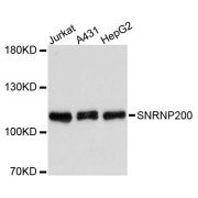 Western blot analysis of extracts of various cell lines, using SNRNP200 antibody (abx004666) at 1:3000 dilution.