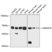 Western blot analysis of extracts of various cell lines, using SNRNP70 antibody (abx004668) at 1/1000 dilution.