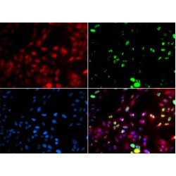 DNA Polymerase Kappa (POLK) Antibody